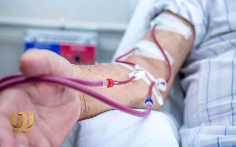 arterial connections - kidney dialysis patients