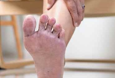 ما هى أفضل طرق علاج جميع أشكال القدم السكرى